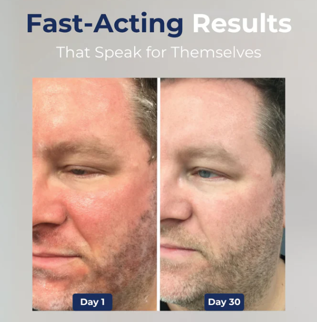 StrongHold Advanced Beard Skin Cream