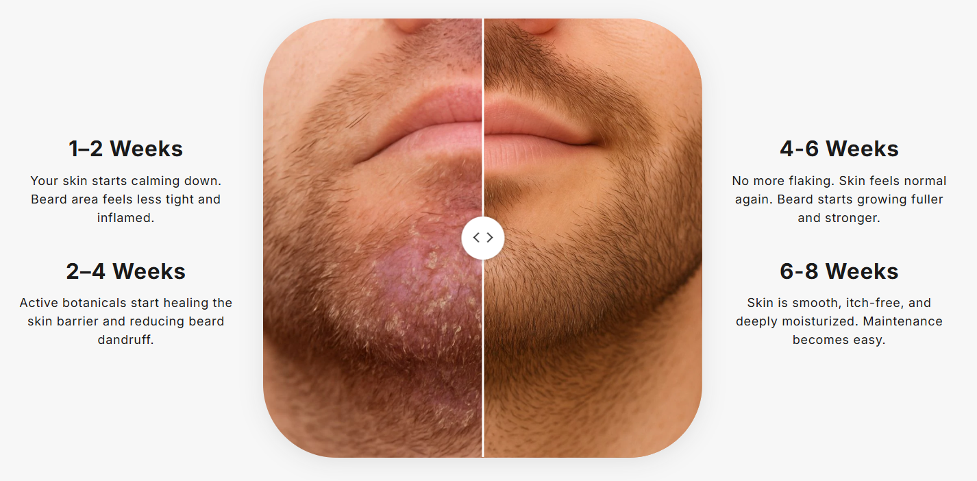 StrongHold Advanced Beard Skin Cream